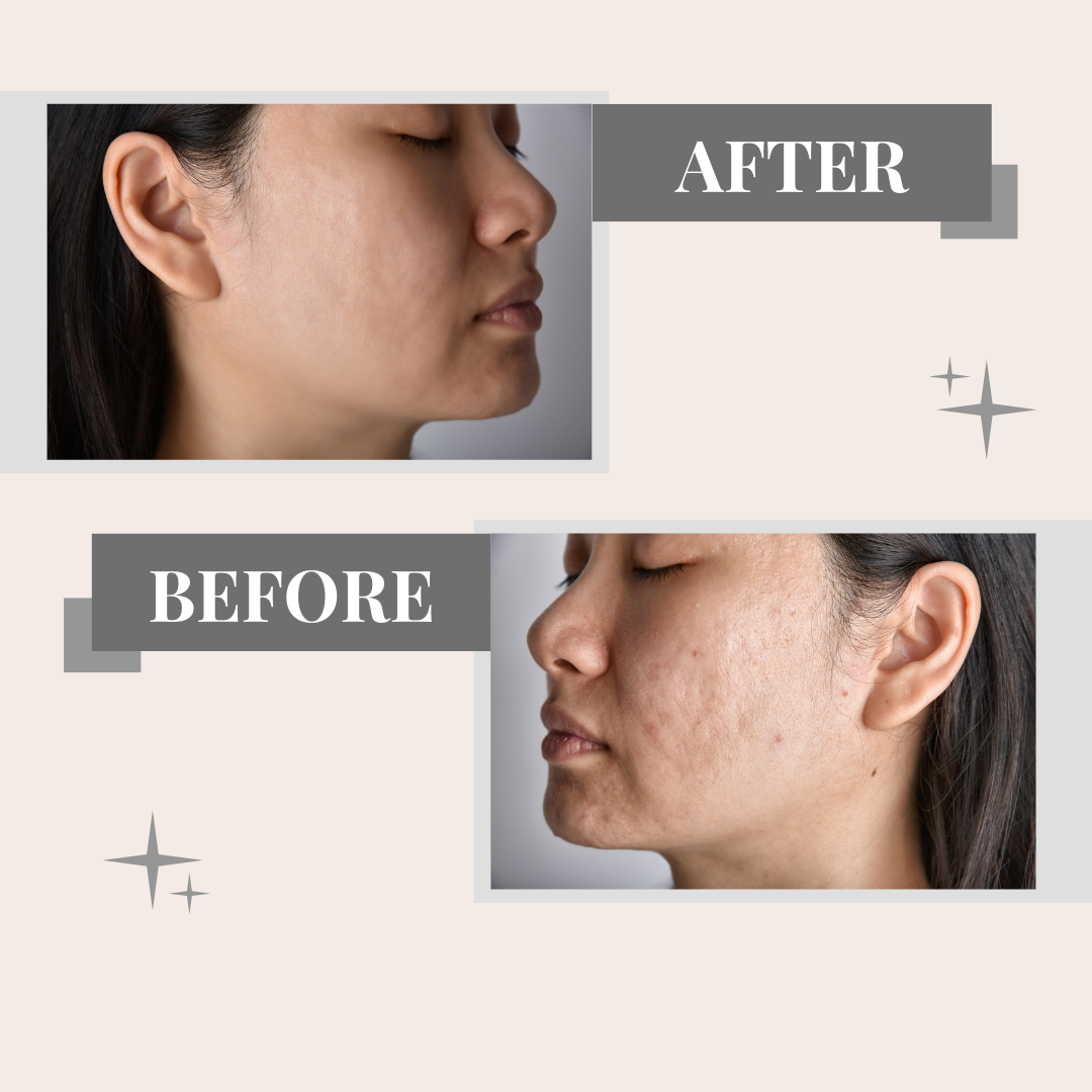 Face Serum Skin Hydrating Anti-Wrinkle Essence - Korean Derma - Image 5